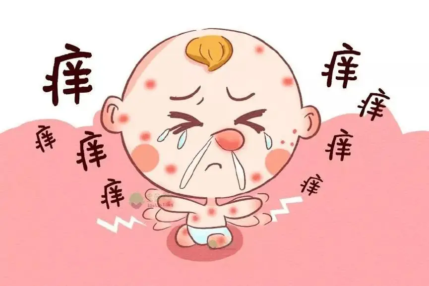 葡萄糖酸钙为什么能够止痒？