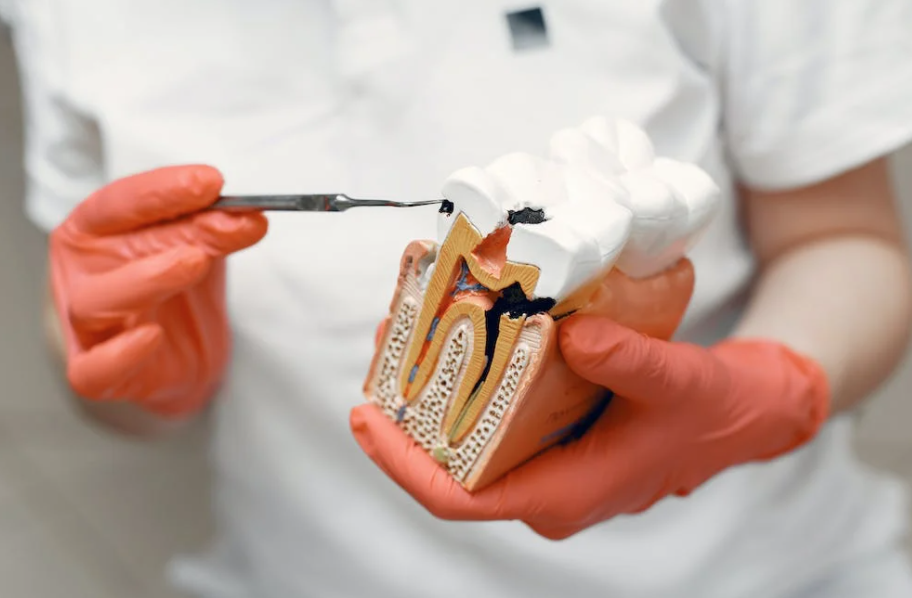 烂牙根不拔有哪些风险，你都知道吗？-PEMEGE贝美吉