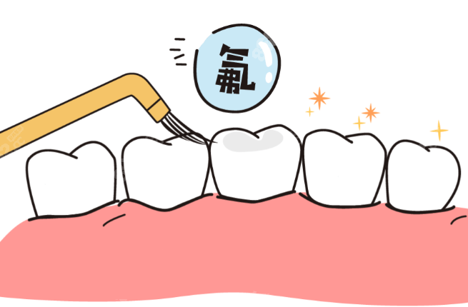 涂氟会致氟斑牙吗？-PEMEGE贝美吉